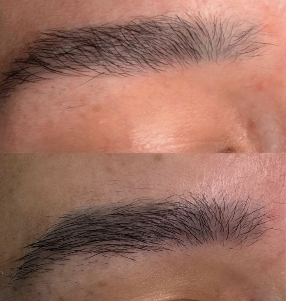 Brow and hair growth repair micro-needling at Berkem Brows Coolangatta