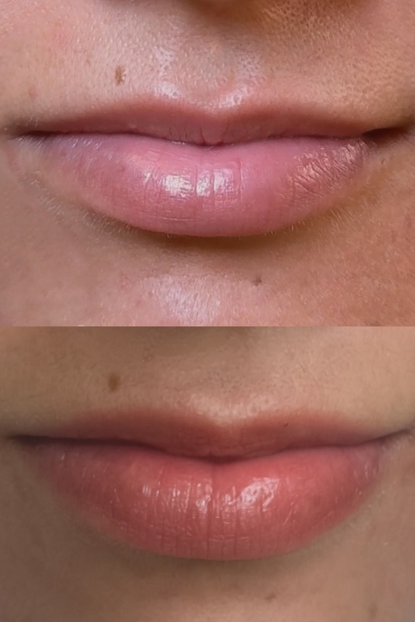 BB Glow Lip and Hydralips treatments at Berkem Brows Coolangatta